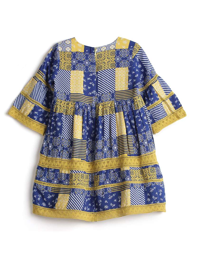 yellow cotton frock - 17423256 -  Standard Image - 1