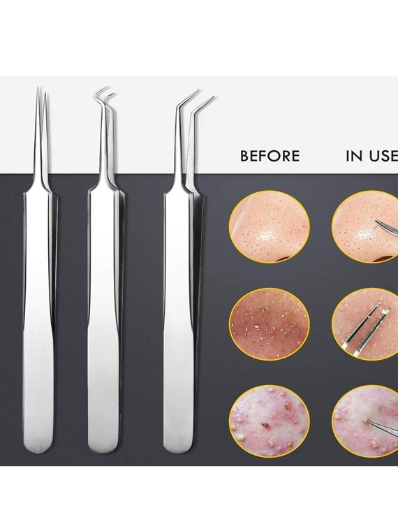 alis 8 pcs blackhead remover tweezer kit | comedone extractor whitehead acne blemish pimple remover & professional dental set - 18308183 - Standard Image - 1