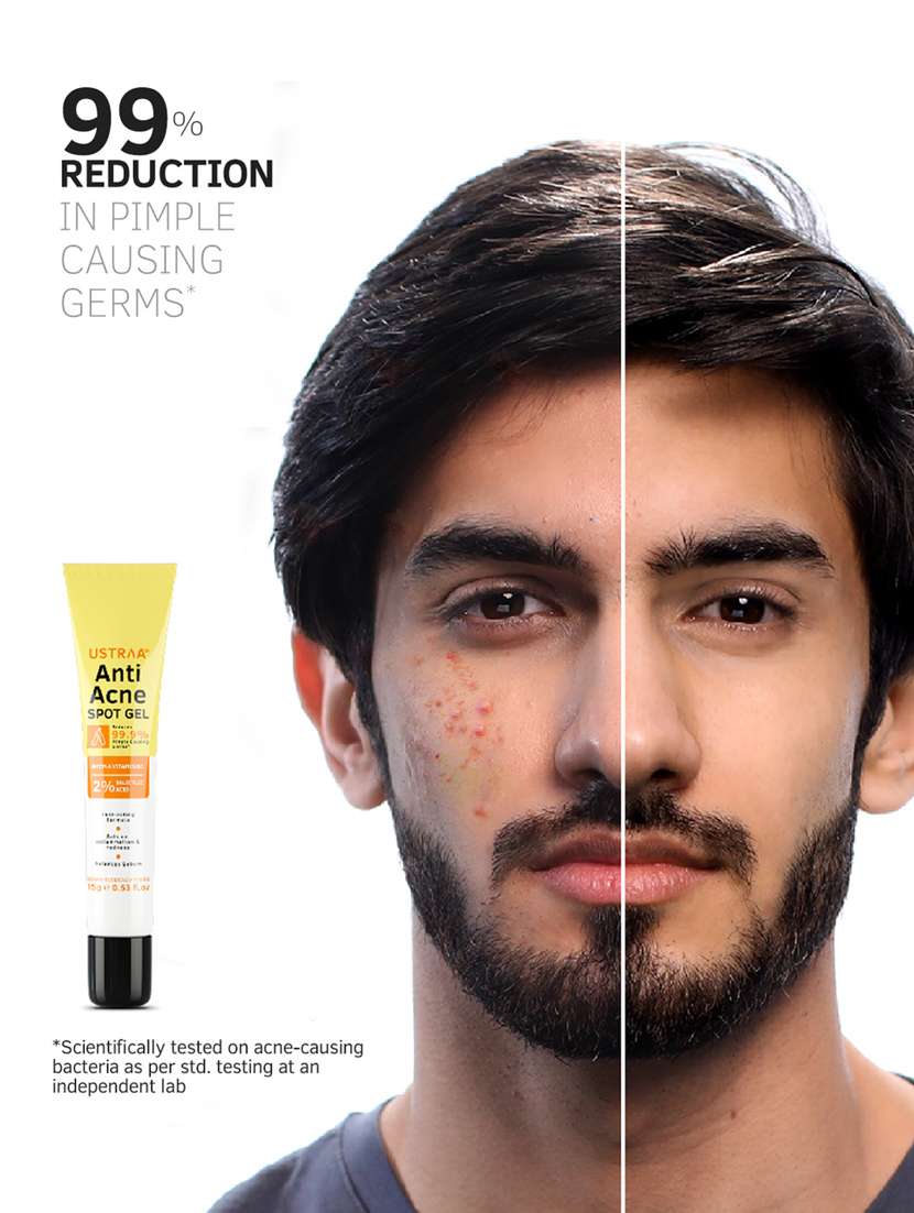 anti acne spot gel - 18326364 - Standard Image - 4
